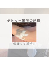 プレジール(Plaisir)/ポイント箇所の施術