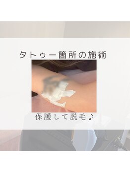 プレジール(Plaisir)/ポイント箇所の施術