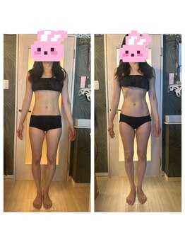 サロン ド オージャス(salon de ojas)/ビフォアフお腹太もも