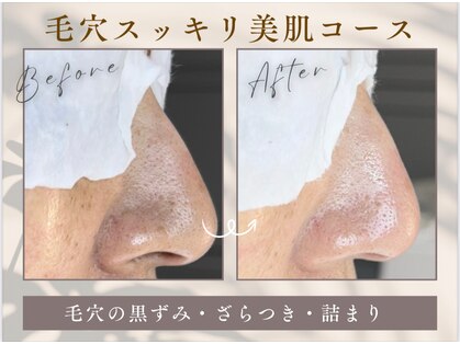 ミルメルシー(mille merci)の写真