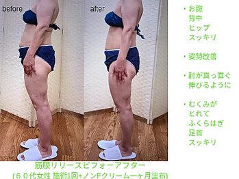 ビューティサロン オハナ(ohana)/筋膜リリース+ノンFクリーム塗布