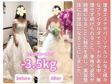 美容整体院アサシ 鴻巣院(美容整体院ASASHI)/姿勢も綺麗になりたくて、、