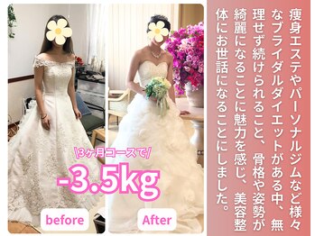 美容整体院アサシ 鴻巣院(美容整体院ASASHI)/姿勢も綺麗になりたくて、、