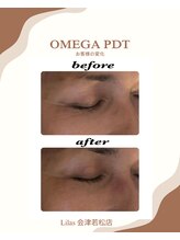 リラ(Lilas)/劇的変化！最新LED光