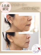 レイア 中城店(RayA)/たるみに！テラボーラー！