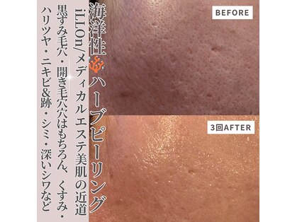 クラルテアンドコー(Salon Clarte&Co.)の写真
