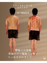 ラクア/腰痛でお悩みのお客様