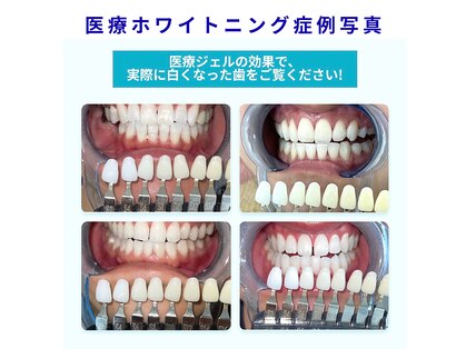 ビーホワイト 名古屋金山店(BE WHITE)の写真