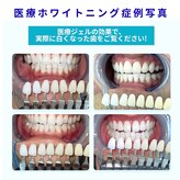 ビーホワイト 名古屋金山店(BE WHITE)