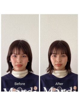 チャンス 西院(chance)/【むくみ/小顔】Before&After