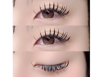 ウニ(uni)の写真
