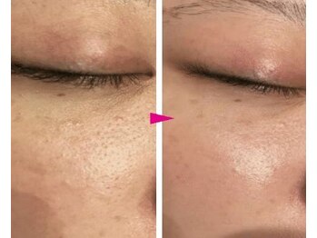 プリオール 高崎花水木店(Prior)/ヒト幹細胞×エステダーマ