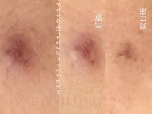 サロンヴェアリー 広尾(salon vary)/敏感肌の方にも！