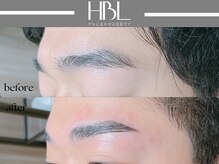 アポロ(Apollo)/ハリウッドブロウリフト