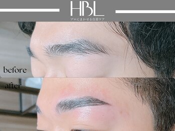 アポロ(Apollo)/ハリウッドブロウリフト