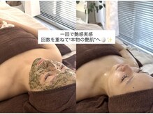 アルテ 神戸(Arte)の雰囲気（REVIハーブピーリング/ニキビ/ケア/赤み/くすみ）