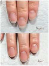 ソワン(soin)/Before→After