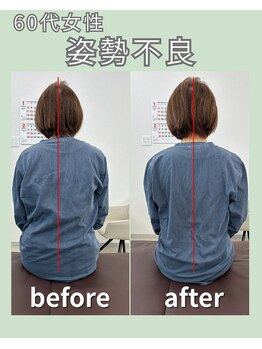 みらい 大島店/姿勢女性ビフォーアフター
