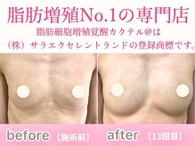 サラエクセレント 新宿(SARA EXCELLENT)の雰囲気(カウンセリングからバストアップニストにお任せ♪元祖脂肪増殖店)