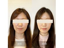 サニー(SUNNY)の雰囲気（圧倒的効果の艶肌小顔効果をご体感下さい【福井市/小顔矯正】）