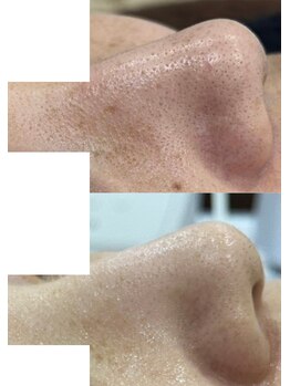 ブレス イオン酒田南店(BLESS)/毛穴ケアもお任せください