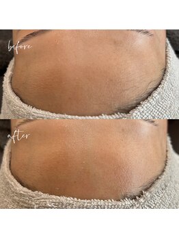 ノン(Non.)/ヌクレールフェイシャルワックス