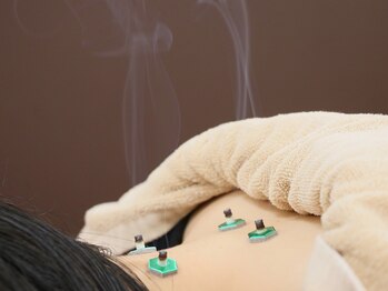 ほねつぎ 高津はりきゅう接骨院/お灸で冷え解消★