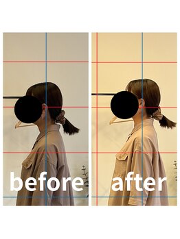 熊本カワル整体 JR上熊本駅院/頭部の位置