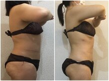 美容整体 ウェリナ 蟹江院/小顔矯正/骨盤矯正/美脚サロン