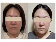 晴れ晴れ整体院の雰囲気（小顔モニター募集第2弾！頭痛や肩こりの原因にも？継続にも定評）