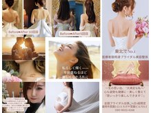 ビルーチェ(美LUCE)