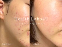 ヘルスラボフォーユー(Health Labo4U)の雰囲気（丁寧な施術と結果にこだわるスキンケアで一度で体感♪）