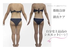 プリマルーチェ/夏に向けて最高のシルエットへ♪