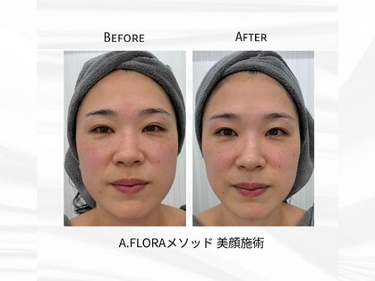 ア フローラ 恵比寿店(A FLORA)の写真