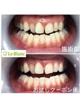 ルブラン 奈良店(Le Blanc)/お帰りなさい!!