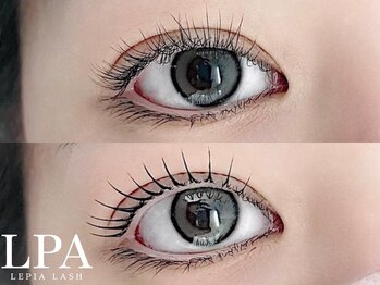 レピア 仙台店/韓国式LEPIA Before&Aｆter