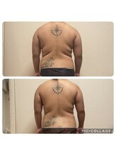 ニアベル(Nia Belle)/リヴァイセルボディ