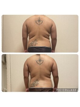 ニアベル(Nia Belle)/リヴァイセルボディ