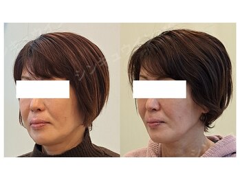 鍼灸院アゼ(AZE)/お顔の変化