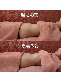 ソワンテラピー(Soin Therapy)/腸もみ+骨盤調整 1回