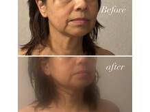 ハチハチ(808)/相模原美容鍼灸院