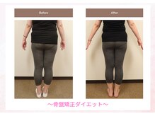 えのもと美容整体院/当院自慢の☆骨盤矯正ダイエット