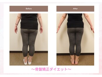 えのもと美容整体院/当院自慢の☆骨盤矯正ダイエット