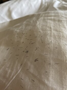 グランズ 芦屋(GLANZ)/初回ヒゲ脱毛無料体験数日後画像