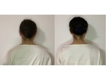 桂整体院/変化を実感!左から右へと