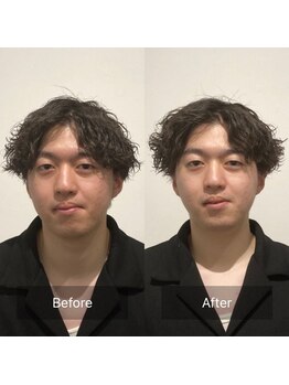 美容整体プラスフィール 恵比寿本店/小顔・目の高さ・大きさ