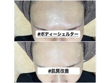 ボディーシェルター 横浜桜木町/VOSサロンケア