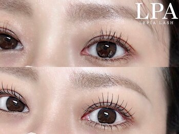 レピア 仙台店/韓国式LEPIA Before&Aｆter