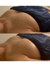 ミリミリ(mili mili)/before→after