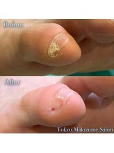 巻き爪補正店 那覇店/